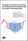 Grundlagen und klinische Anwendung der Prostataarterien-Embolisation (PAE) bei benigner Prostatahyperplasie - Attila Kovács - 9783837424355
