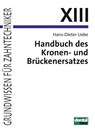 Handbuch des Kronen- und Brückenersatzes - Hans-Dieter Uebe - 9783929360097