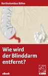 Wie wird der Blinddarm entfernt? - Bartholomäus Böhm - 9783942825641