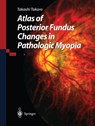 Atlas of Posterior Fundus Changes in Pathologic Myopia - Takashi Tokoro - 9784431680185