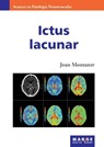 Ictus lacunar - Joan Montaner - 9788415340393