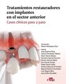 Tratamientos restauradores con implantes en el sector anterior. Casos clínicos paso a paso - Ignacio Rodríguez ; José Espona Roig ; Carlos Fernández Villares ; David García Baeza - 9788418706448