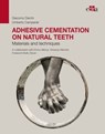 Adhesive cementation on natural teeth - Giacomo Derchi ; Umberto Campaner ; Enrico Manca ; Vincenco Marchio - 9788821453731
