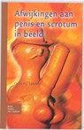 Afwijkingen aan penis en scrotum in beeld - Leliefeld - 9789031352920