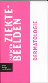 Zakboek ziektebeelden Dermatologie -  - 9789031364688