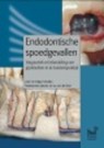 Endodontische spoedgevallen - Edgar Schäfer ; Luc van der Sluis - 9789085620631