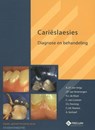 Carieslaesies-studenteneditie - A.J.P. van Strijp ; J.P. van Amerongen ; H.J. de Kloet ; C. Loveren - 9789085621355