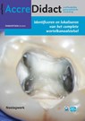 Identificeren en lokaliseren van het complete wortelkanaalstelsel - Michael Drefs - 9789089763198