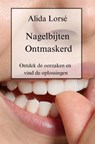 Nagelbijten Ontmaskerd - Alida Lorsé - 9789403751610