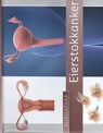 Zorgatlas Eierstokkanker - Arnold Krüse ; Wim Van der Steeg ; Bernadette Rigterink ; Roelien Schaapman - 9789491984488