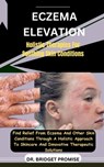 Eczema Elevation: Holistic Therapies For Soothing Skin Conditions: Find Relief From Eczema And Other Skin Conditions Through A Holistic - Bridget Promise - 9798875955983