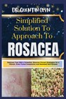 Simplified Solution Approach To ROSACEA: Embrace Your Skin's Potential: Discover Proven Strategies for a Vibrant, Even-Toned Complexion and Renewed Se - Quentin Glyn - 9798876709585