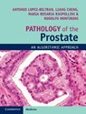 Pathology of the Prostate - LOPEZ-BELTRAN,  Antonio - 9781108185653