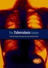 The Tuberculosis Update - SILVERSTEIN,  Alvin - 9780766024816