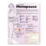 Understanding Menopause Anatomical Chart -  - 9780781773133