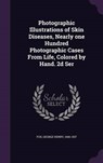 Photographic Illustrations of Skin Diseases, Nearly One Hundred Photographic Cases from Life, Colored by Hand. 2D Ser - FOX,  George Henry - 9781341669019