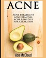 Acne - MCCLOUD,  Ace - 9781640480018
