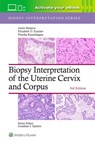 Biopsy Interpretation of the Uterine Cervix and Corpus: Print + eBook with Multimedia - ANAIS MALPICA ; ELIZABETH D. EUSCHER ; Preetha Ramalingam - 9781975236786
