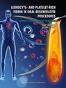 Leukocyte- and Platelet-Rich Fibrin in Oral Regenerative Procedures - Marc Quirynen ; Nelson R. Pinto - 9783868676334