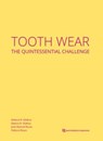 Tooth Wear - Débora R. Vilaboa ; Beatriz R. Vilaboa ; Jose Manuel Reuss ; Débora Reuss - 9783868676518