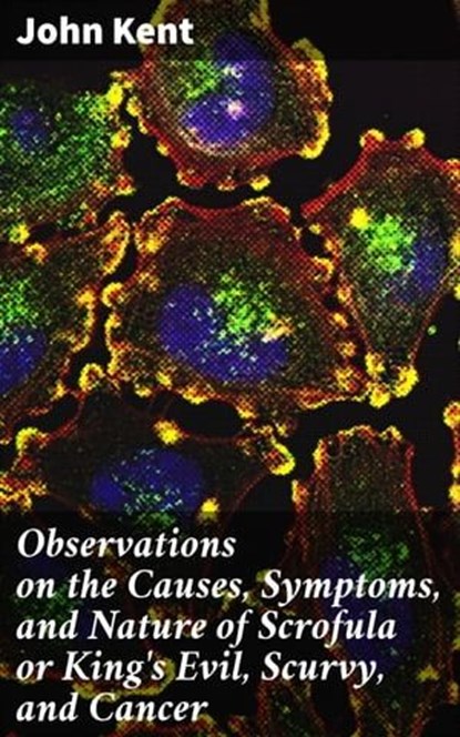Observations on the Causes, Symptoms, and Nature of Scrofula or King's Evil, Scurvy, and Cancer, John Kent - Ebook - 4064066177447