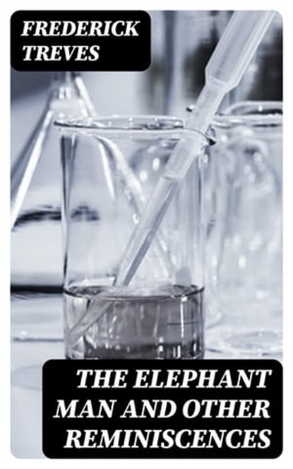 The Elephant Man and Other Reminiscences, Frederick Treves - Ebook - 8596547179566