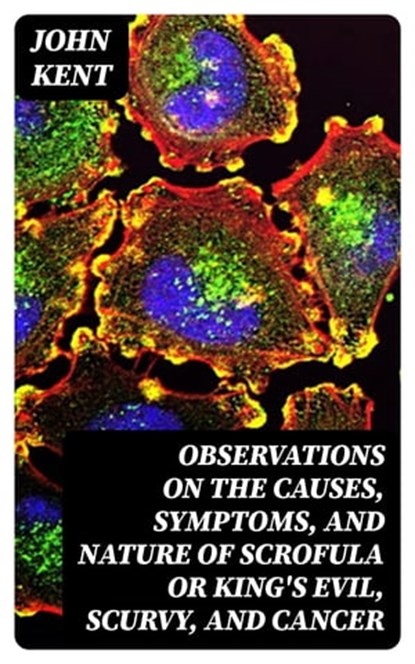 Observations on the Causes, Symptoms, and Nature of Scrofula or King's Evil, Scurvy, and Cancer, John Kent - Ebook - 8596547345282