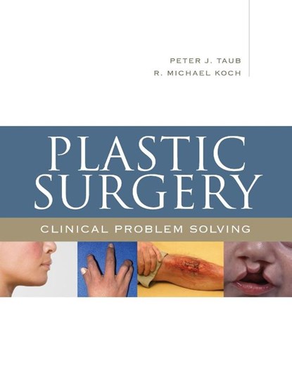 Plastic Surgery, Peter J. Taub ; R. Michael Koch - Paperback - 9780071481502