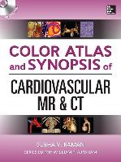 Color Atlas and Synopsis of Cardiovascular MR and CT (SET 2), RAMAN,  Subha - Paperback - 9780071747349