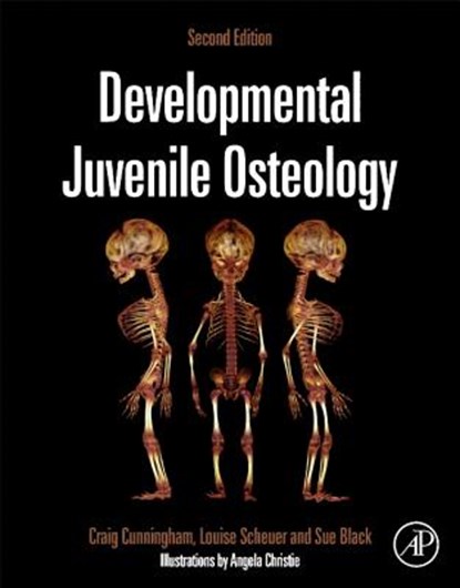 Developmental Juvenile Osteology, Craig (Centre for Anatomy and Human Identification Cunningham ; Louise (Centre for Anatomy and Human identification Scheuer ; Sue (Centre for Anatomy and Human Identification Black - Gebonden - 9780123821065