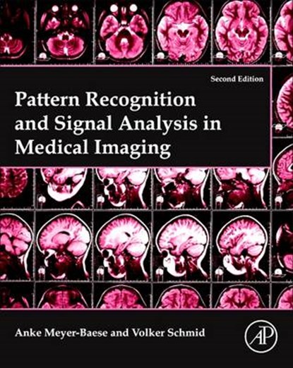 Pattern Recognition and Signal Analysis in Medical Imaging, MEYER-BAESE,  Anke - Paperback - 9780128101162