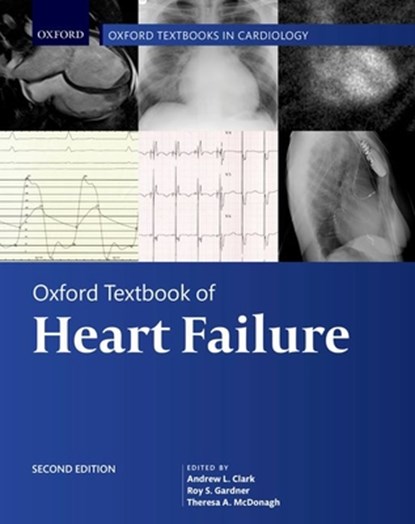 Oxford Textbook of Heart Failure, Andrew (Castle Hill Hospital Clark ; Roy (Scottish National Advanced Heart Failure Service Gardner ; Theresa (Department of Cardiology McDonagh - Gebonden - 9780198766223
