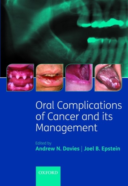 Oral Complications of Cancer and its Management, ANDREW (CONSULTANT IN PALLIATIVE MEDICINE,  The Royal Marsden Hospital, Sutton, UK) Davies ; Joel (Professor, Oral Medicine and Diagnostic Sciences, College of Dentistry and Otolaryngology and Head and Neck Surgery and Cancer Center, College of Medicine, University of Illinois, USA) Epstein - Gebonden - 9780199543588