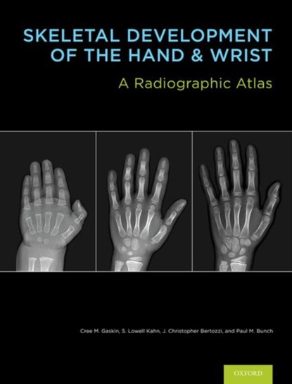 Skeletal Development of the Hand and Wrist, Cree M. (Assistant Professor of Radiology Gaskin ; S. Lowell (Interventional Radiologist Kahn ; J. Christoper (Clinical Instructor Bertozzi ; Paul M. (Musculoskeletal Radiology Bunch - Gebonden - 9780199782055