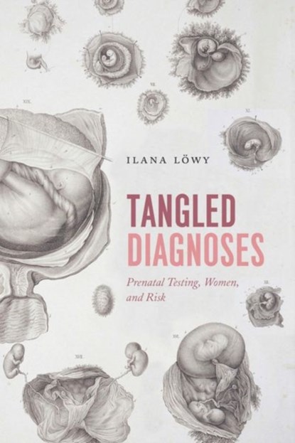 Tangled Diagnoses, Ilana Lowy - Gebonden - 9780226534121
