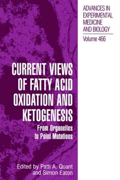 Current Views of Fatty Acid Oxidation and Ketogenesis, niet bekend - Gebonden - 9780306462009