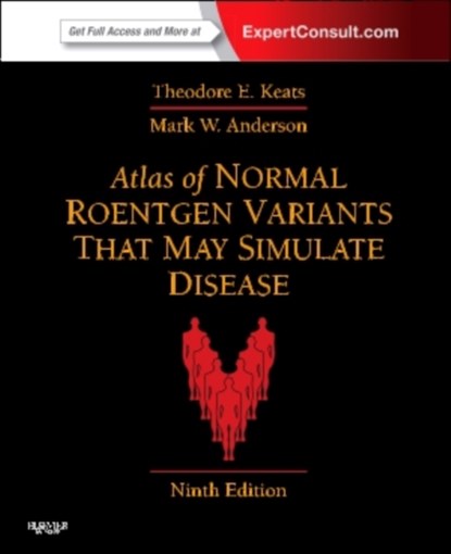 Atlas of Normal Roentgen Variants That May Simulate Disease, Theodore E. (Alumni Professor of Radiology Keats ; Mark W. (Harrison Distinguished Teaching Professor of Radiology; Chief Anderson - Gebonden - 9780323073554