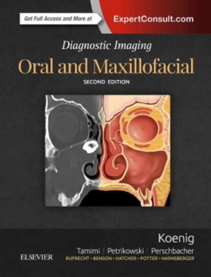 Diagnostic Imaging: Oral and Maxillofacial, LISA J. (PROFESSOR EMERITA,  Oral Medicine and Oral Radiology, Marquette University School of Dentistry, Milwaukee, Wisconsin) Koenig ; Dania Tamimi ; Susanne E. (Assistant Professor, Teaching Stream, and Oral & Maxillofacial Radiology, University of Toronto Faculty of Dentistry, Toronto, Ontario, C - Gebonden - 9780323477826