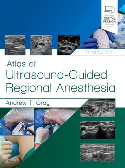 Atlas of Ultrasound-Guided Regional Anesthesia, ANDREW T. (DEPARTMENT OF ANESTHESIA AND PERIOPERATIVE CARE,  UCSF School of Medicine San Francisco, CA) Gray - Gebonden - 9780323509510