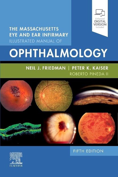 The Massachusetts Eye and Ear Infirmary Illustrated Manual of Ophthalmology, Neil J. (Adjunct Clinical Professor Friedman ; Peter K. (Chaney Family Endowed Chair for Ophthalmology Kaiser ; Roberto Pineda II - Paperback - 9780323613323