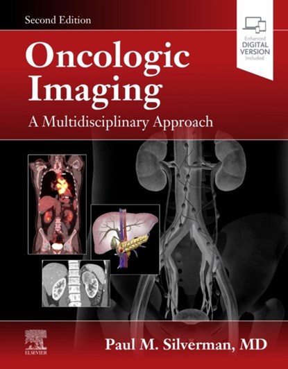 Oncologic Imaging: A Multidisciplinary Approach, PAUL M. (PROFESSOR OF RADIOLOGY,  Retired; Gerald D. Dodd, Jr., Distinguished Chair and Director of Academic Development for Diagnostic Imaging, Department of Diagnostic Radiology, The University of Texas MD Anderson Cancer Center, Houston, Texas) Silverman - Gebonden - 9780323695381
