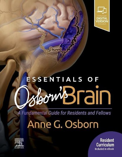 Essentials of Osborn's Brain, Anne G. Osborn - Gebonden - 9780323713207