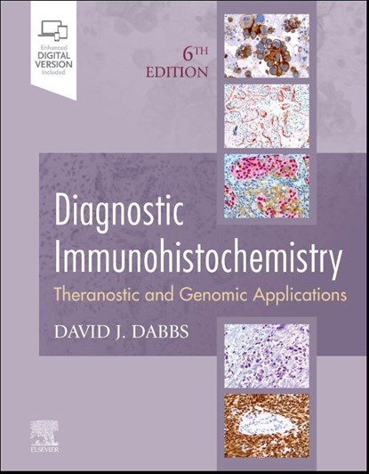 Diagnostic Immunohistochemistry, David J. (Professor of Pathology Dabbs - Gebonden - 9780323721721