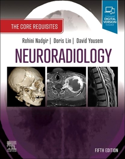 Neuroradiology, Rohini (Assistant Professor Nadgir ; Doris Lin ; David M. (Associate Dean for Professional Development Yousem - Paperback - 9780323759755