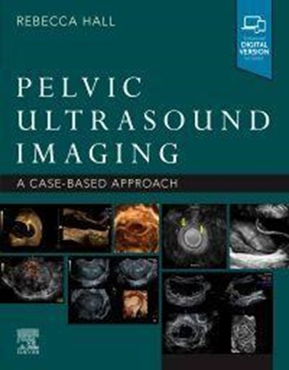 Pelvic Ultrasound Imaging, Rebecca Hall - Paperback - 9780323789783