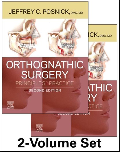 Orthognathic Surgery - 2 Volume Set, Jeffrey C. Posnick - Gebonden - 9780323791823