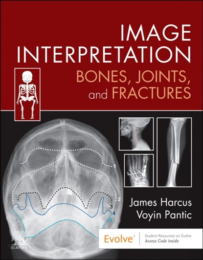 Image Interpretation: Bones, Joints, and Fractures, James (Lecturer in Diagnostic Imaging Harcus ; Voyin Pantic - Paperback - 9780323870801