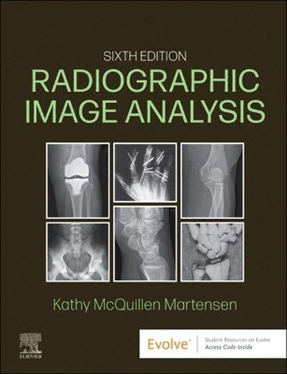 Radiographic Image Analysis, Kathy McQuillen Martensen - Gebonden - 9780323930697