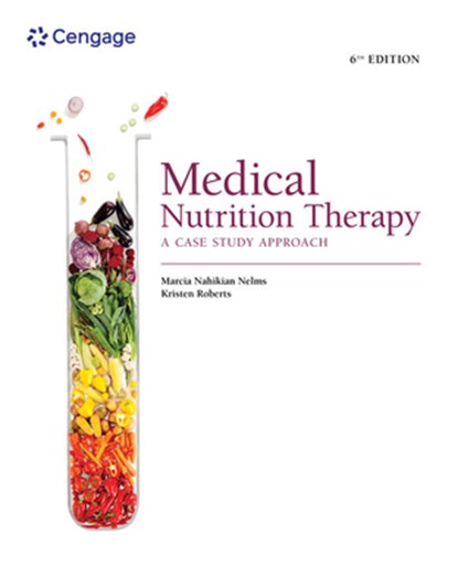 Medical Nutrition Therapy, Kristen (The Ohio State University) Roberts ; Marcia (The Ohio State University) Nelms - Paperback - 9780357450680