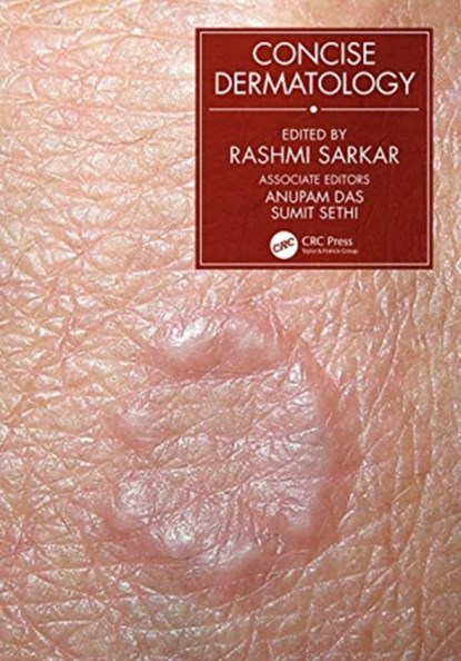 Concise Dermatology, Rashmi Sarkar - Gebonden - 9780367533656